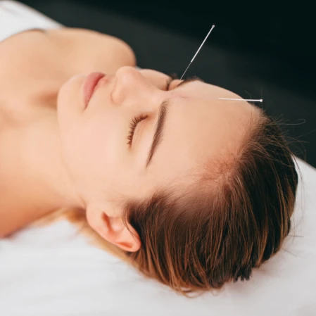 Aculifting, le lifting anti-âge non invasif au Puy en Velay Photo d'une séance d'aculifting