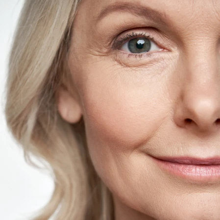 Aculifting, à quelle âge commencer ? Photo d'une femme d'un âge mûr