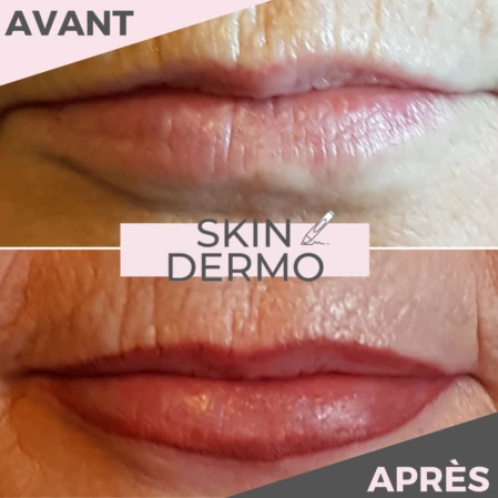 Photo avant/après d'un maquillage permanent des lèvres
