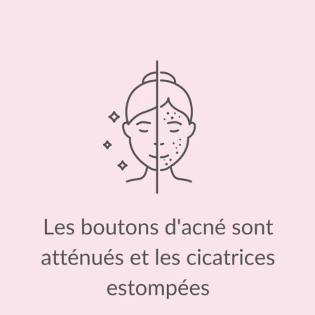 Pictogramme LED thérapie pour le traitement de l'acné La LED thérapie pour traiter l'acné et estomper les cicatrices