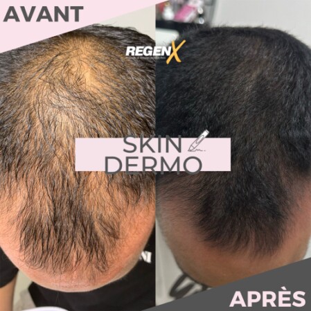 soin de reconstruction des poils et des cheveux