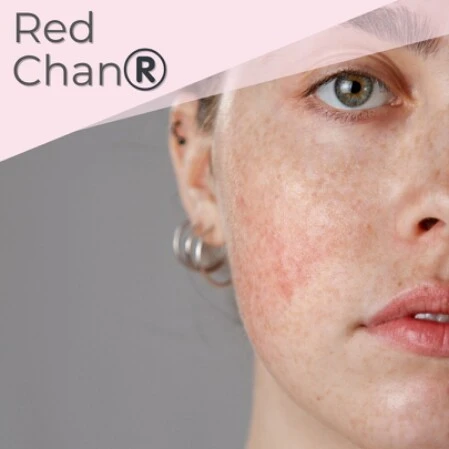 Apaiser les peaux réactives avec RED CHAN®️ pour les peaux couperosées.