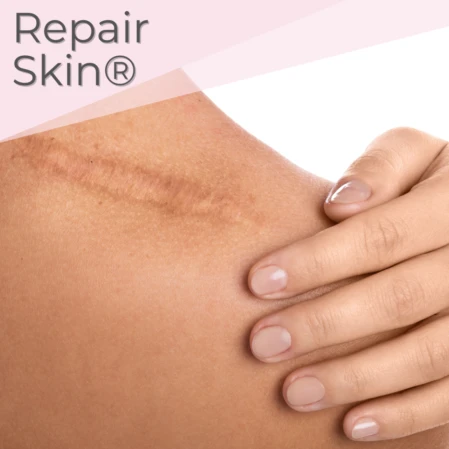 Soin réparateur et cicatrisant pour les cicatrices et les vergetures Repair Skin Le soin Repair Skin est le soin idéal pour réparer et aider à la cicatrisation de vos cicatrices et de vos vergetures